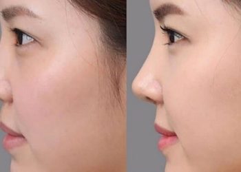 Tướng mũi xấu trong nhân tướng học có đặc điểm gì?