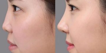 Tướng mũi xấu trong nhân tướng học có đặc điểm gì?