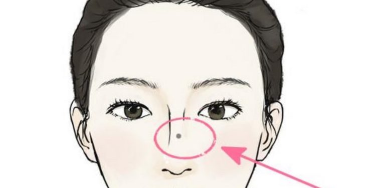 Ý nghĩa vị trí nốt ruồi trên khuôn mặt người nam và nữ